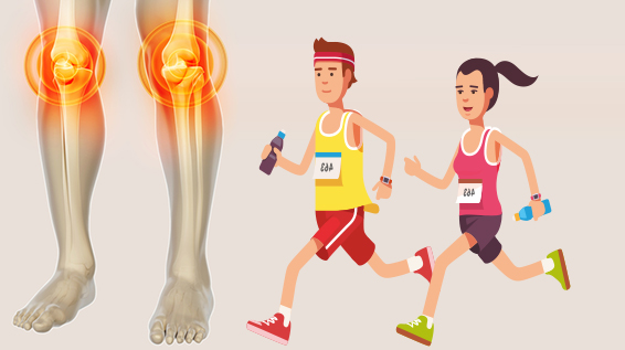 Knieschmerzen beim Laufen: Vermeide diese 3 Fehler